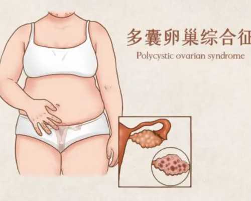 国内供卵做试管,南宁做一次试管婴儿需要准备多少钱？